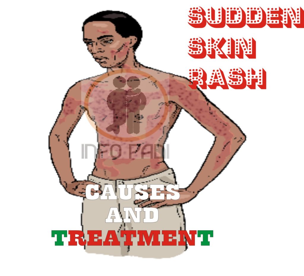 Kern Rash SKIN RASHES- Possible Causes of Skin Rashes and ways to properly avoid ...